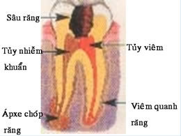 CÁC KHÁI NIỆM LIÊN QUAN ĐẾN NỘI NHA