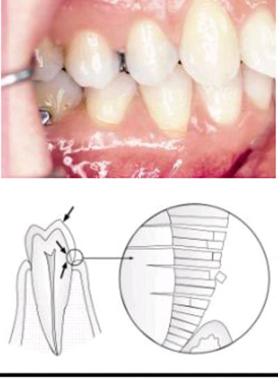 MÒN RĂNG THÔNG TIN CẦN BIẾT